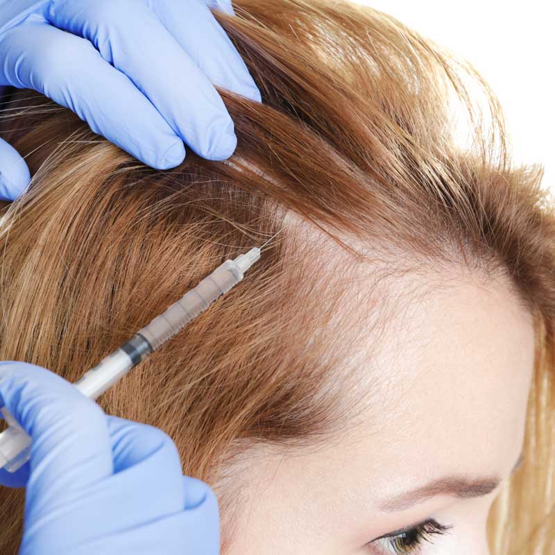 Alopecia how to deals treat