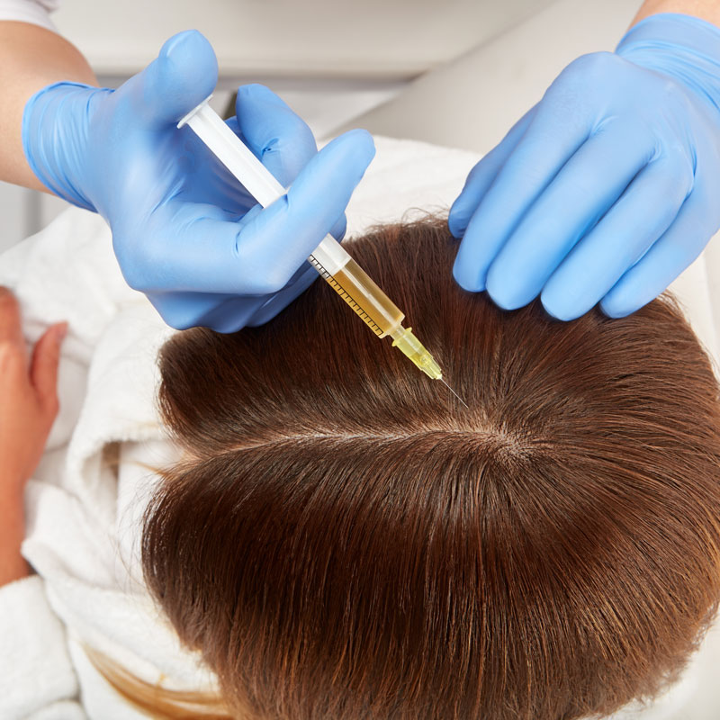 A dermatologist injecting a solution into the head of a patient