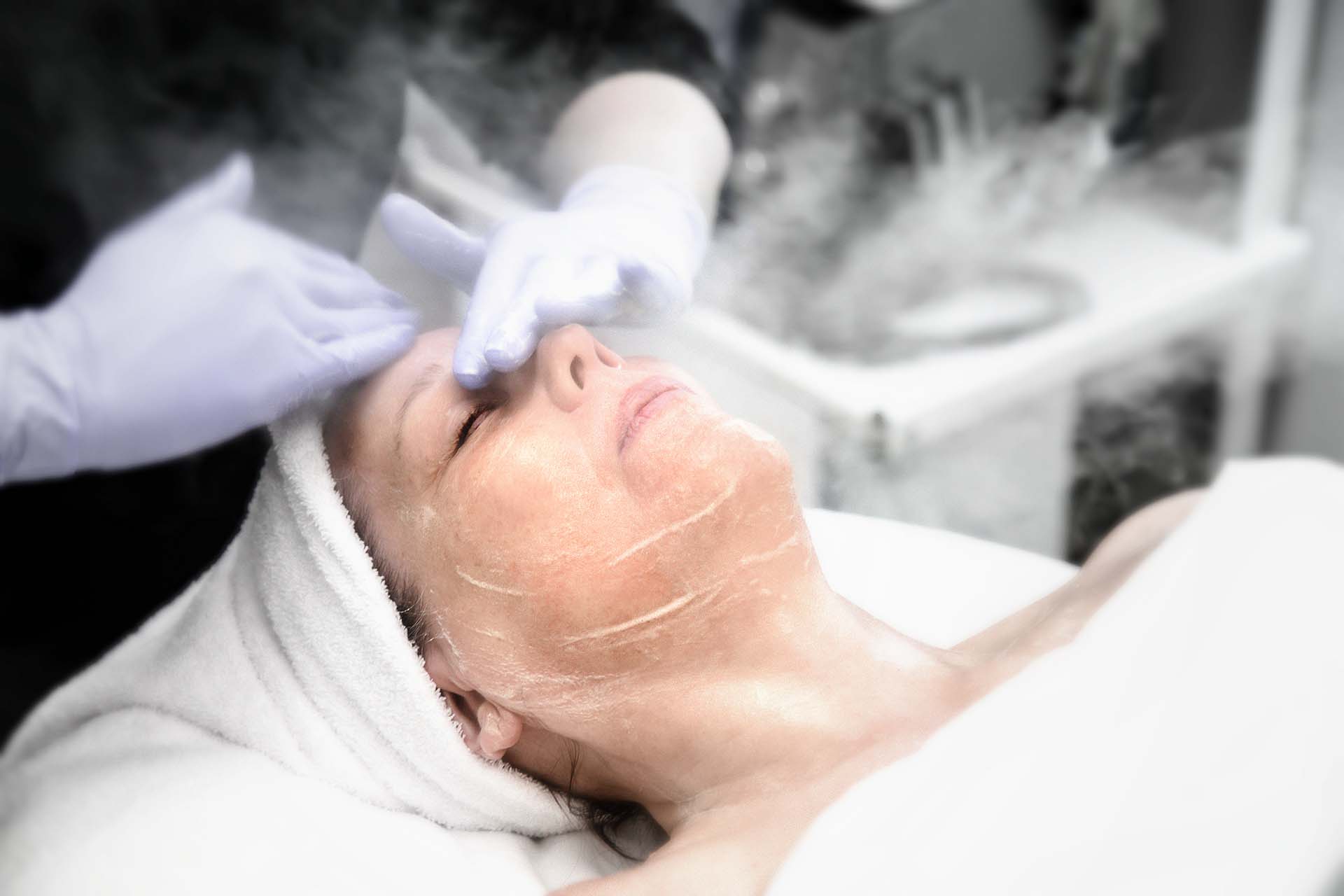 What is the Difference Between a Light, Medium, and Deep Chemical Peel?