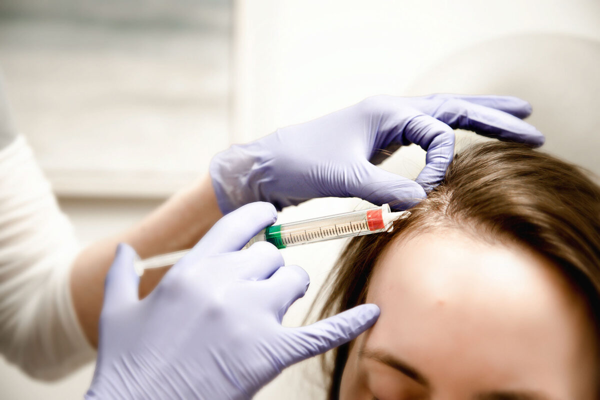 PRP Microneedling